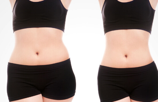 伊盈专业减肥加盟