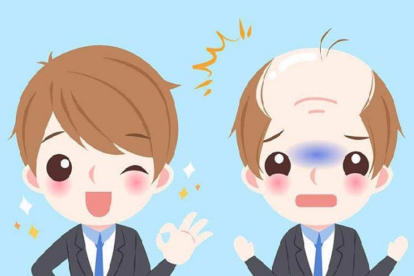 熙朵植发加盟费