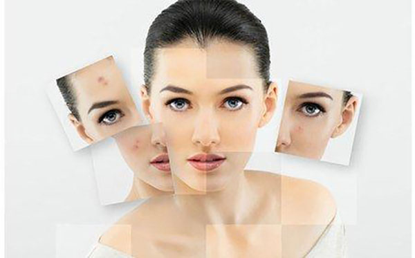 优玛除疤加盟店