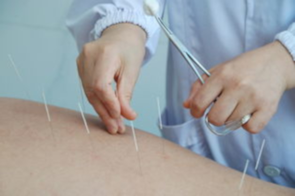 穴位减肥加盟费