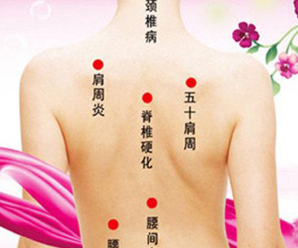 海口塑美经络减肥加盟