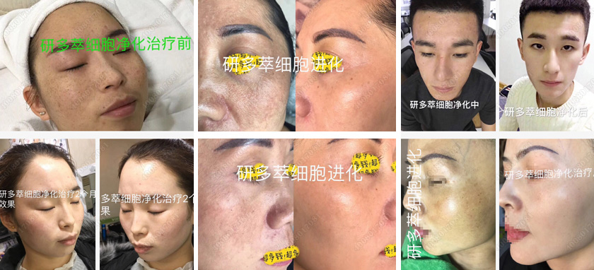 研多萃皮肤管理