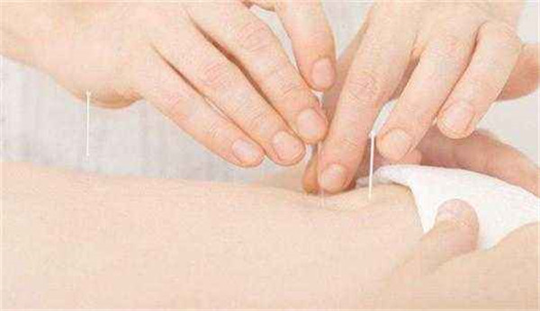 针灸减肥加盟店