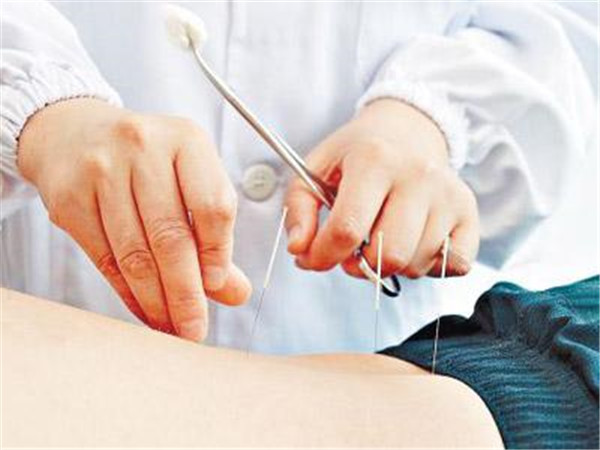 针灸减肥加盟店