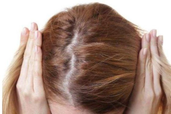 脱发生发加盟费