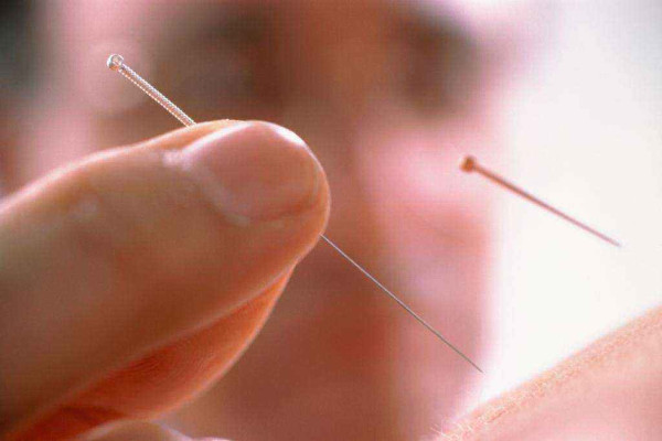 中医针灸馆加盟费