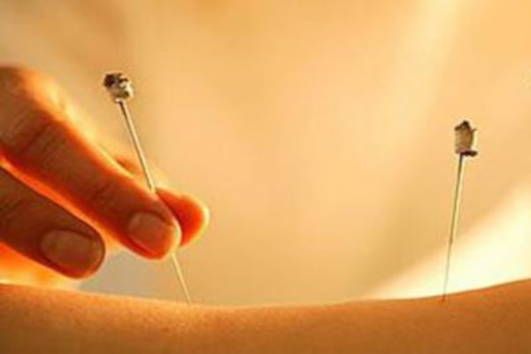 中医针灸馆加盟费