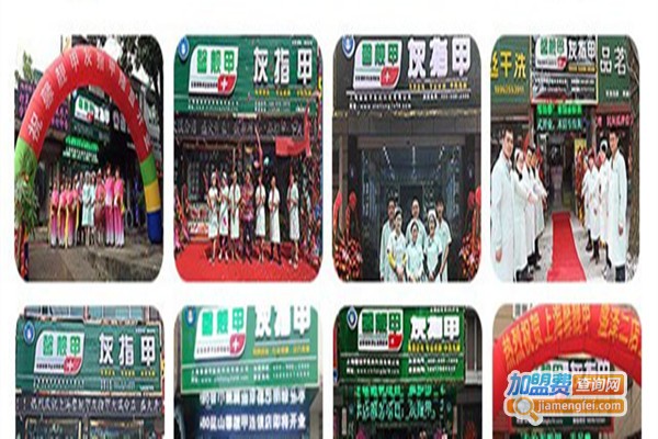 灰指甲修复连锁加盟费