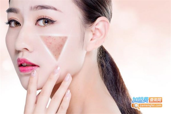 蝶变专业祛斑祛痘加盟