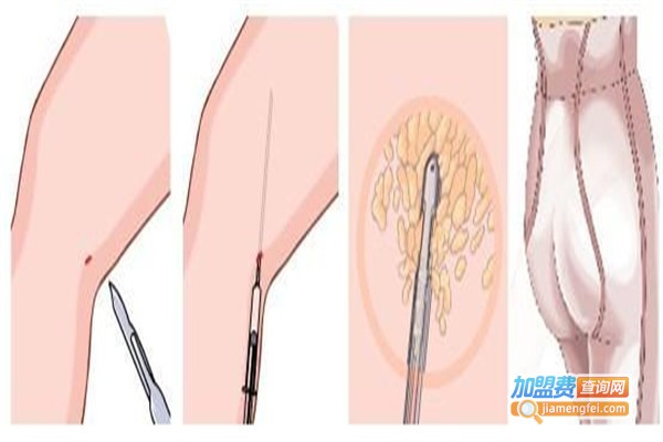 格莱美美容加盟费