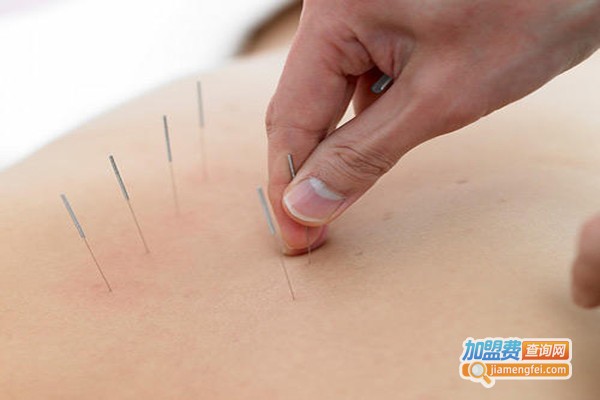 子午流注亚健康调理加盟门店