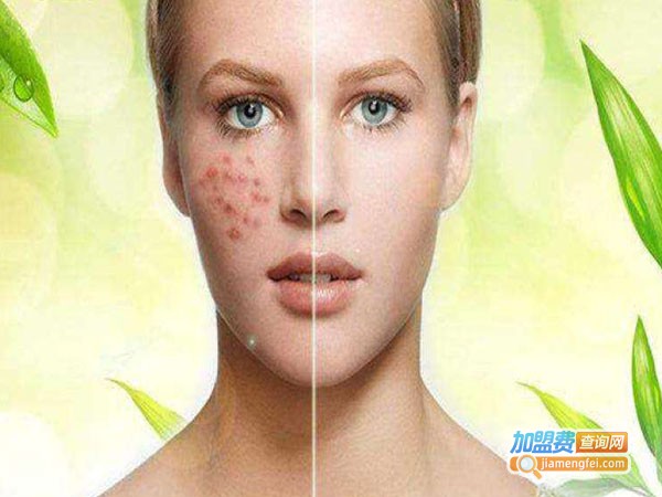 华诺致美祛斑祛痘