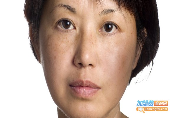 若水缘专业祛痘加盟费