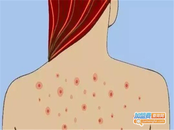 安之元肤家皮肤病中心加盟费