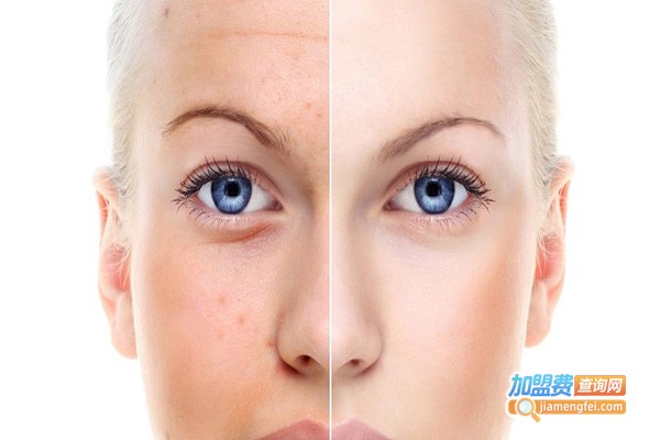 焕颜祛斑祛痘中心加盟费