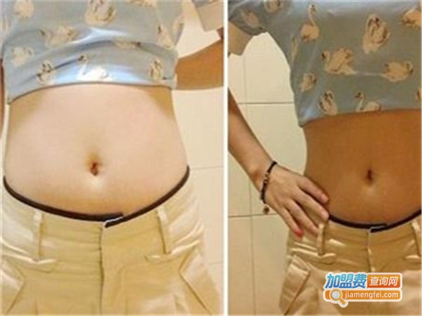 张氏刮刮瘦加盟费