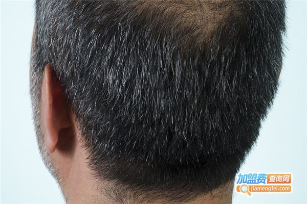 苗草堂养发连锁店加盟