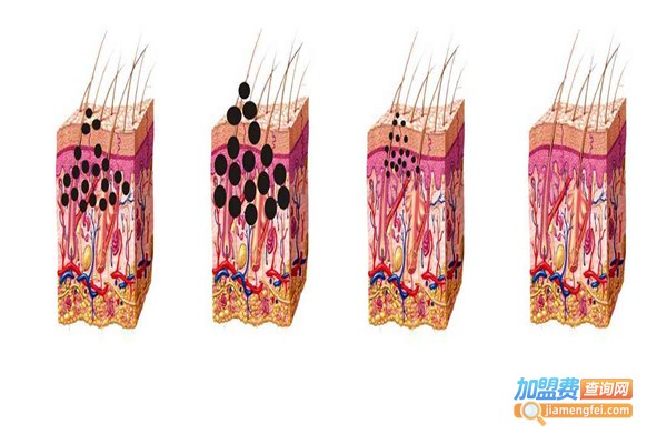 倾姿堂祛斑加盟费