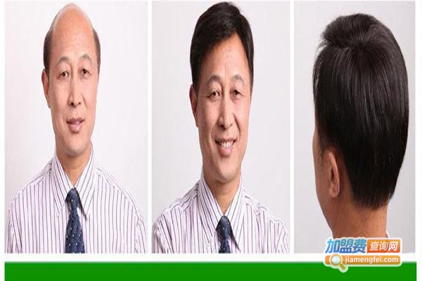 韩美黛织发补发加盟总部