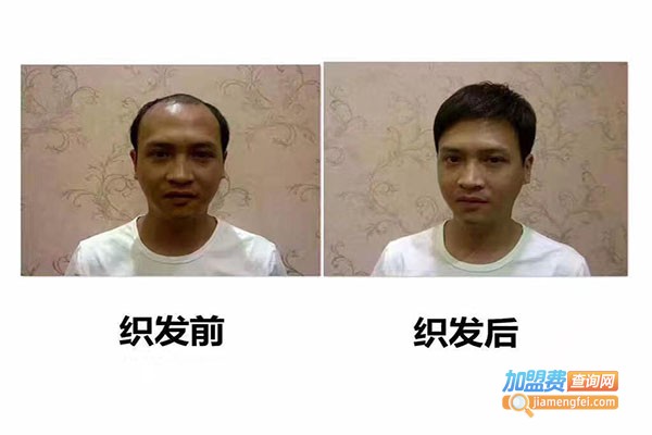 韩美黛织发补发加盟总部