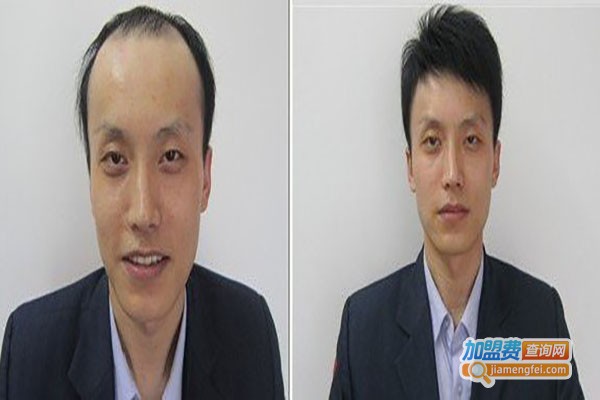 韩美黛织发补发加盟总部