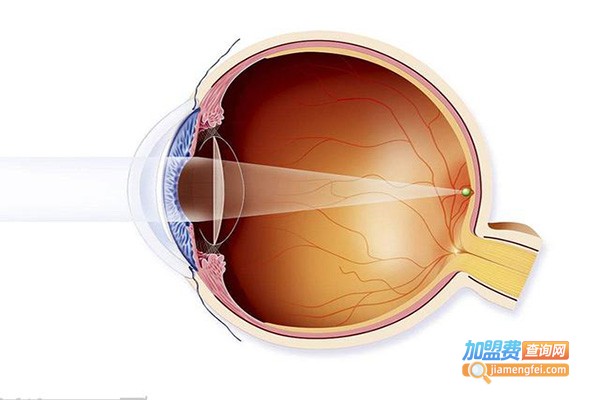 贞视光学加盟费