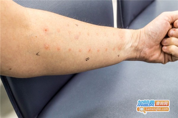 5+5疤痕医生加盟费