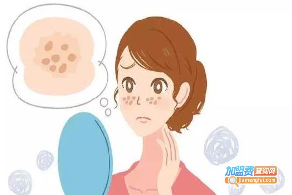 曲氏祛斑加盟费