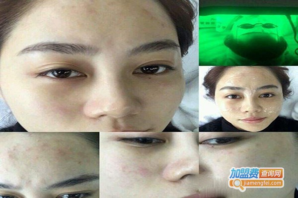 菲颜皮肤管理加盟门店