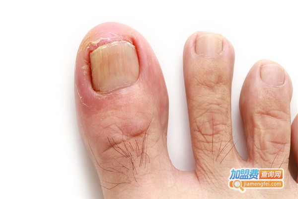 健甲堂健康用品加盟费