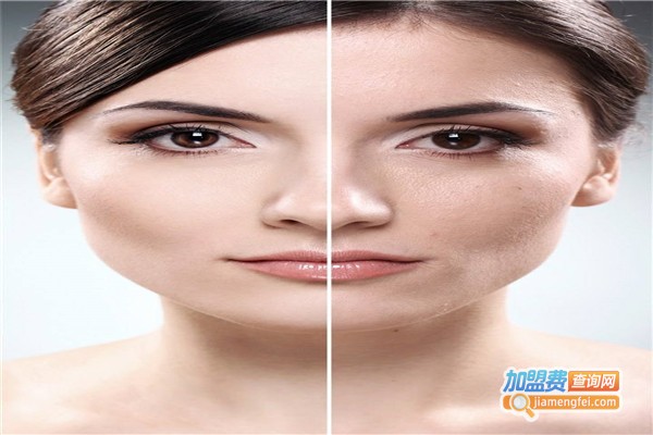 宛央（法国）科技美肤中心加盟