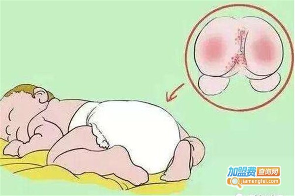 杰宝屁屁纸加盟费