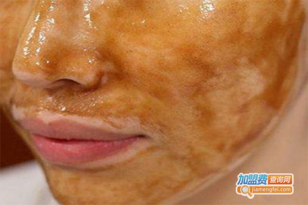 雪花秀撕拉面膜加盟费