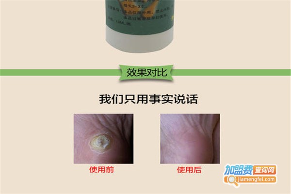 溢美保健加盟费