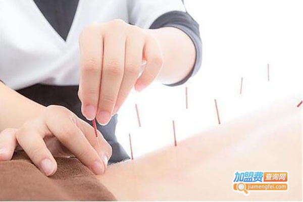 可力水针灸加盟费