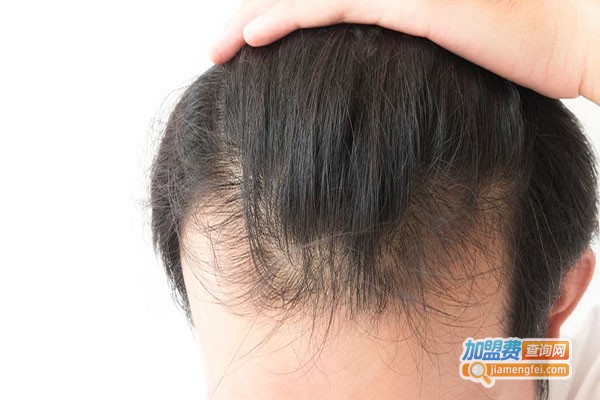 倍尔秀防脱生发洗发水加盟费