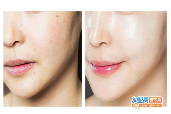 一生美红参素颜霜加盟费