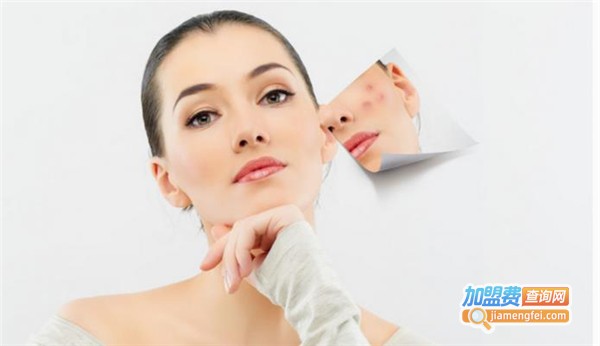 韩雪梦祛痘加盟费