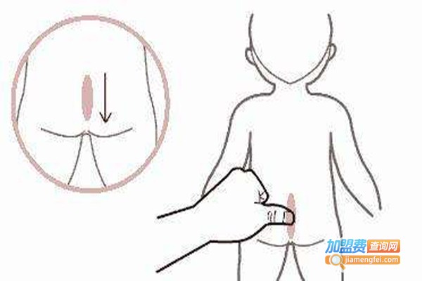 雀屏小儿推拿加盟费