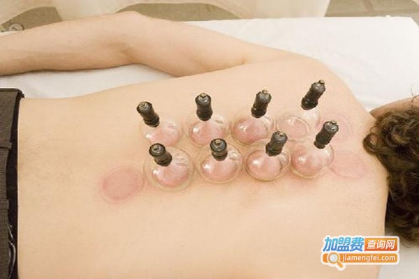 吕氏拔罐减肥加盟费