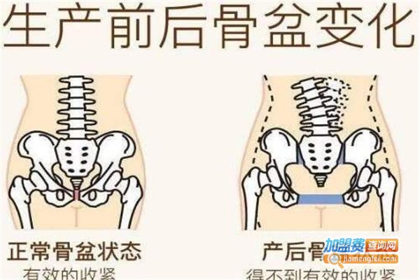 依魅儿产后恢复加盟费