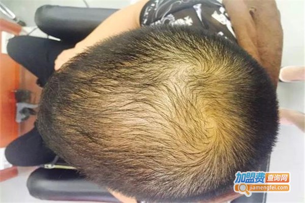 德洛莉丝生发加盟费