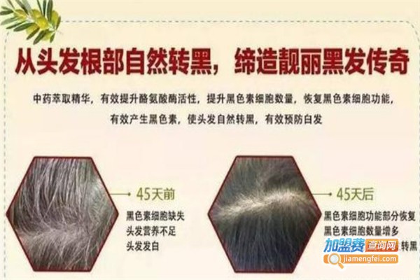 德洛莉丝生发加盟费