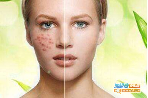 素妍国际祛斑祛痘加盟费