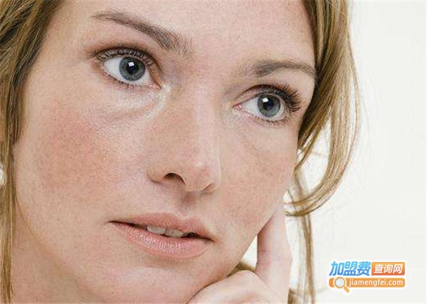 诗淇美颜祛斑加盟