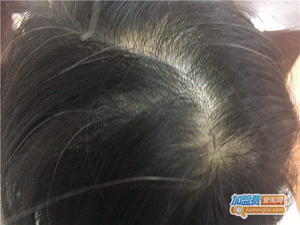 春和头皮护理加盟费