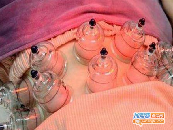 拔罐减肥培训加盟费