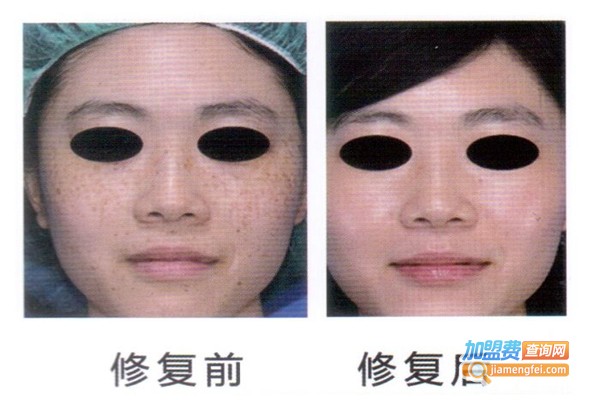 曲祖颜方加盟费