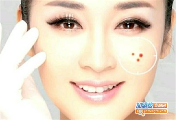 李木子祛斑加盟费