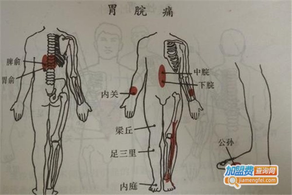 中药蜡疗加盟费